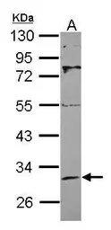 Anti-SIRT3 antibody used in Western Blot (WB). GTX115701