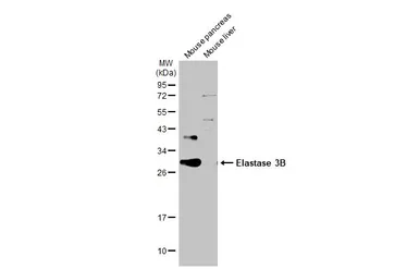 Anti-Elastase 3B antibody used in Western Blot (WB). GTX115702