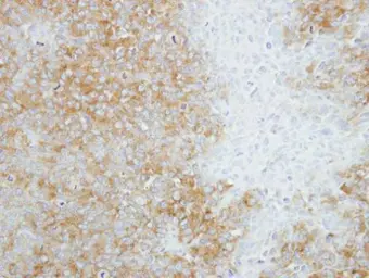 Anti-SEC14L2 antibody [N1C1] used in IHC (Paraffin sections) (IHC-P). GTX115717