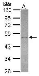 Anti-SEC14L2 antibody [N1C1] used in Western Blot (WB). GTX115717