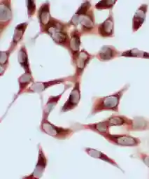 Anti-Hsp70 antibody used in Immunocytochemistry/ Immunofluorescence (ICC/IF). GTX11573