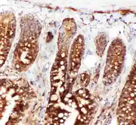 Anti-Hsp70 antibody used in IHC (Frozen sections) (IHC-Fr). GTX11573