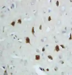 Anti-Hsp70 antibody used in IHC (Paraffin sections) (IHC-P). GTX11573