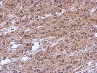 Anti-MKRN2 antibody used in IHC (Paraffin sections) (IHC-P). GTX115731