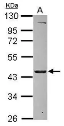 Anti-MKRN2 antibody used in Western Blot (WB). GTX115731