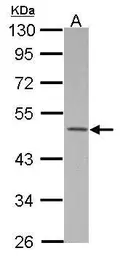 Anti-MKRN2 antibody [N1C1] used in Western Blot (WB). GTX115732