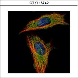 Anti-RABGAP1 antibody [C2C3], C-term used in Immunocytochemistry/ Immunofluorescence (ICC/IF). GTX115742