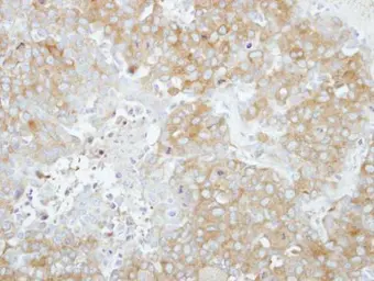Anti-RABGAP1 antibody [C2C3], C-term used in IHC (Paraffin sections) (IHC-P). GTX115742