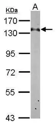 Anti-RABGAP1 antibody [C2C3], C-term used in Western Blot (WB). GTX115742