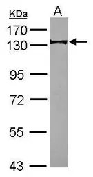 Anti-RABGAP1 antibody [C2C3], C-term used in Western Blot (WB). GTX115742