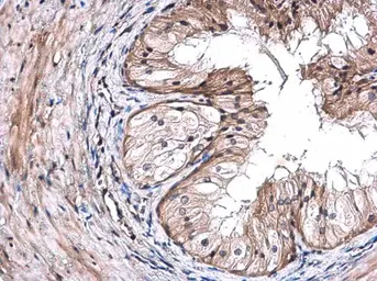 Anti-TRIM29 antibody [C1C3] used in IHC (Paraffin sections) (IHC-P). GTX115749