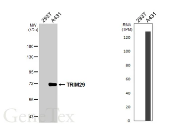 Anti-TRIM29 antibody [C1C3] used in Western Blot (WB). GTX115749