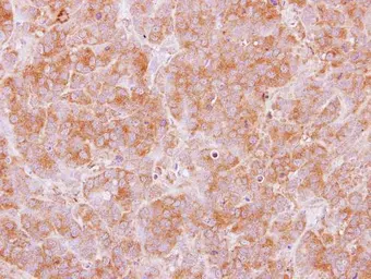 Anti-TRIM29 antibody [C1C3] used in IHC (Paraffin sections) (IHC-P). GTX115749