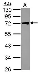 Anti-TRIM29 antibody [C1C3] used in Western Blot (WB). GTX115749