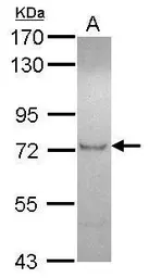 Anti-ZFP95 antibody [C1C3] used in Western Blot (WB). GTX115752
