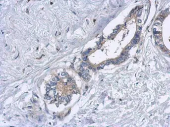 Anti-EML2 antibody [N1N3] used in IHC (Paraffin sections) (IHC-P). GTX115761