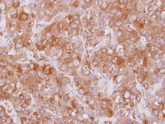 Anti-EML2 antibody [N2C2], Internal used in IHC (Paraffin sections) (IHC-P). GTX115762