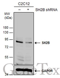 Anti-SH2B antibody used in Western Blot (WB). GTX115780