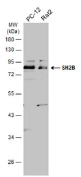 Anti-SH2B antibody used in Western Blot (WB). GTX115780