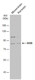 Anti-SH2B antibody used in Western Blot (WB). GTX115780