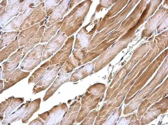 Anti-APPL1 antibody [N1N2], N-term used in IHC (Paraffin sections) (IHC-P). GTX115786