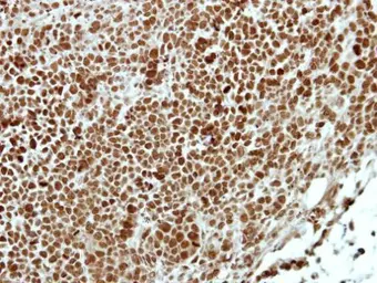 Anti-APPL1 antibody [N1N2], N-term used in IHC (Paraffin sections) (IHC-P). GTX115786