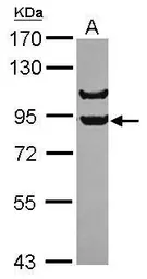 Anti-APPL1 antibody [C1C3] used in Western Blot (WB). GTX115787