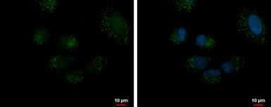 Anti-DECR2 antibody used in Immunocytochemistry/ Immunofluorescence (ICC/IF). GTX115788