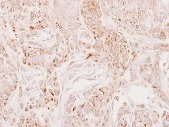 Anti-DECR2 antibody used in IHC (Paraffin sections) (IHC-P). GTX115788