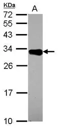 Anti-DECR2 antibody used in Western Blot (WB). GTX115788