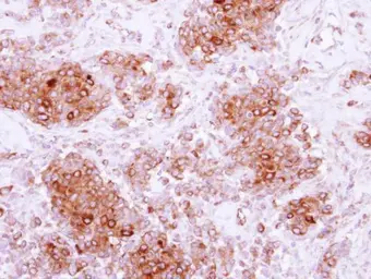 Anti-ARH antibody used in IHC (Paraffin sections) (IHC-P). GTX115793