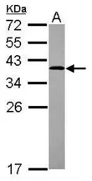 Anti-ARH antibody used in Western Blot (WB). GTX115793