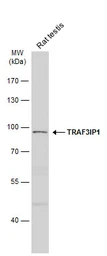 Anti-TRAF3IP1 antibody [N1N2], N-term used in Western Blot (WB). GTX115798