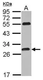 Anti-PITPNC1 antibody used in Western Blot (WB). GTX115802
