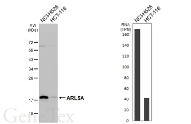 Anti-ARL5A antibody used in Western Blot (WB). GTX115803