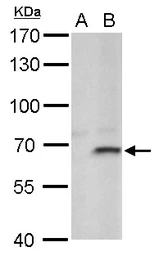 Anti-FBL4 antibody [C1C3] used in Western Blot (WB). GTX115808