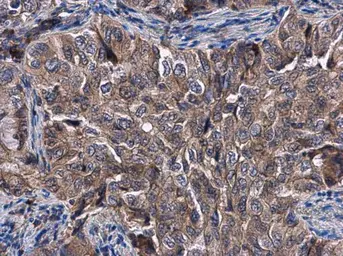 Anti-KLHL3 antibody [N1C1] used in IHC (Paraffin sections) (IHC-P). GTX115809