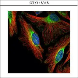Anti-FBXO4 antibody used in Immunocytochemistry/ Immunofluorescence (ICC/IF). GTX115815