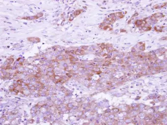 Anti-ARFGAP3 antibody [N3C3] used in IHC (Paraffin sections) (IHC-P). GTX115818