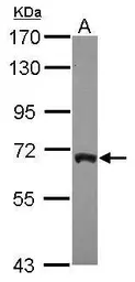 Anti-ARFGAP3 antibody [N3C3] used in Western Blot (WB). GTX115818