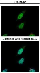 Anti-NARF antibody [N3C2], Internal used in Immunocytochemistry/ Immunofluorescence (ICC/IF). GTX115821