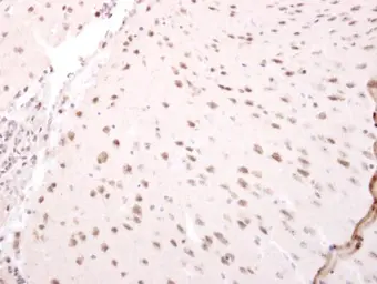 Anti-NARF antibody [N3C2], Internal used in IHC (Paraffin sections) (IHC-P). GTX115821