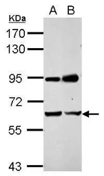 Anti-NARF antibody [N3C2], Internal used in Western Blot (WB). GTX115821