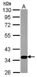 Anti-SLC17A5 antibody used in Western Blot (WB). GTX115822