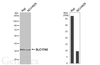Anti-SLC17A5 antibody used in Western Blot (WB). GTX115822