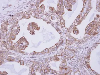 Anti-Cyclin M4 antibody [C2C3], C-term used in IHC (Paraffin sections) (IHC-P). GTX115824