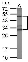 Anti-TZFP antibody used in Western Blot (WB). GTX115832