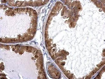 Anti-STAU2 antibody used in IHC (Paraffin sections) (IHC-P). GTX115836