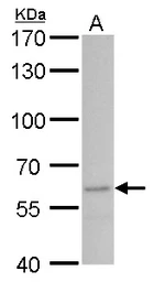 Anti-STAU2 antibody used in Western Blot (WB). GTX115836
