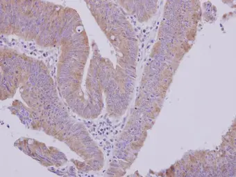 Anti-MTBP antibody [N1N3] used in IHC (Paraffin sections) (IHC-P). GTX115837